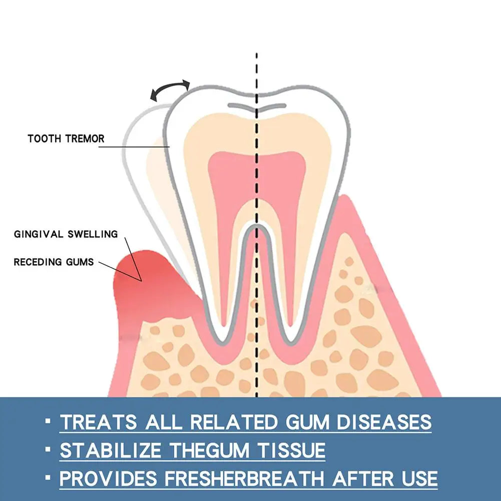 Sérum Reparador de Encías – Alivio y Regeneración Dental