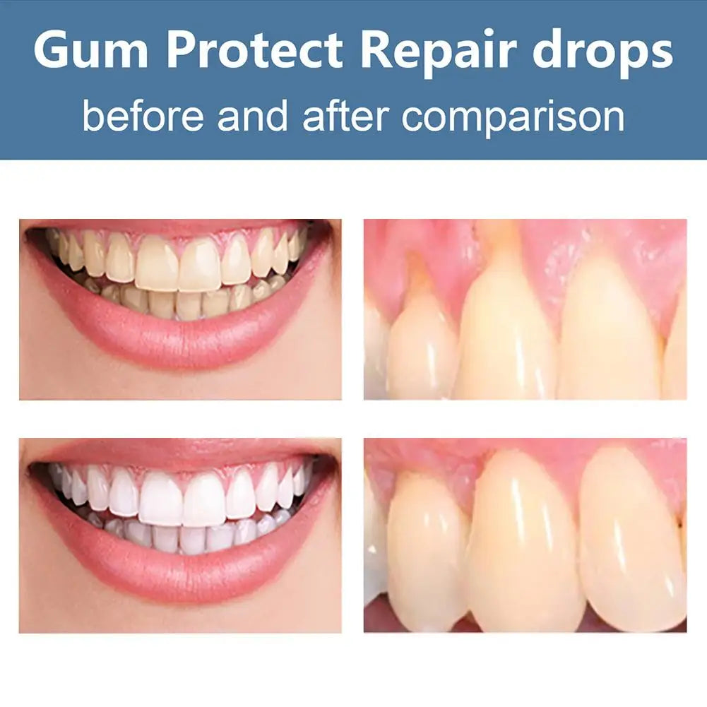 Sérum Reparador de Encías – Alivio y Regeneración Dental