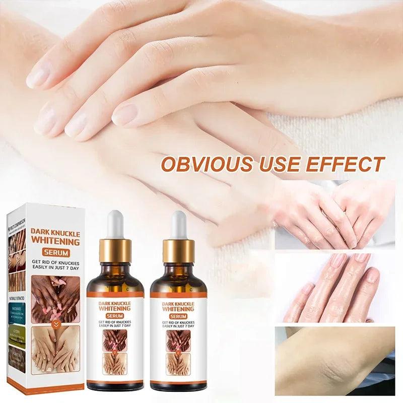 Crema Blanqueadora de Piel – Zonas Oscuras y Cuerpo