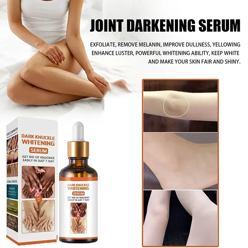 Crema Blanqueadora de Piel – Zonas Oscuras y Cuerpo