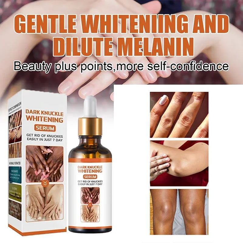 Crema Blanqueadora de Piel – Zonas Oscuras y Cuerpo
