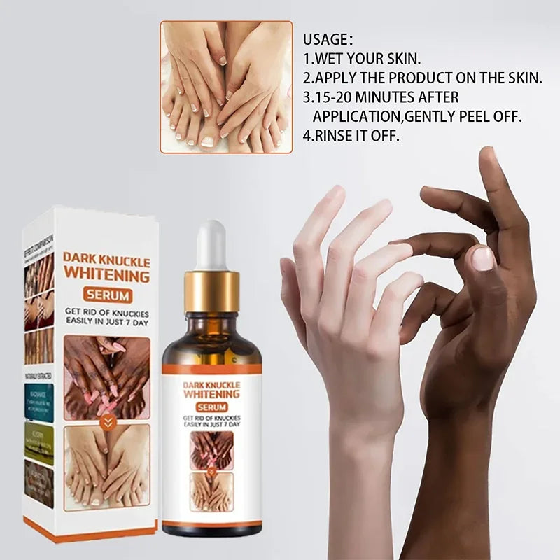 Crema Blanqueadora de Piel – Zonas Oscuras y Cuerpo